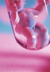 单身可以去联合生育医院做试管吗？需要花费多少钱？